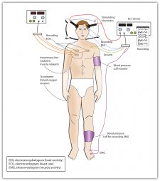 14.2 Reducing Disorder Biologically: Drug and Brain Therapy ...