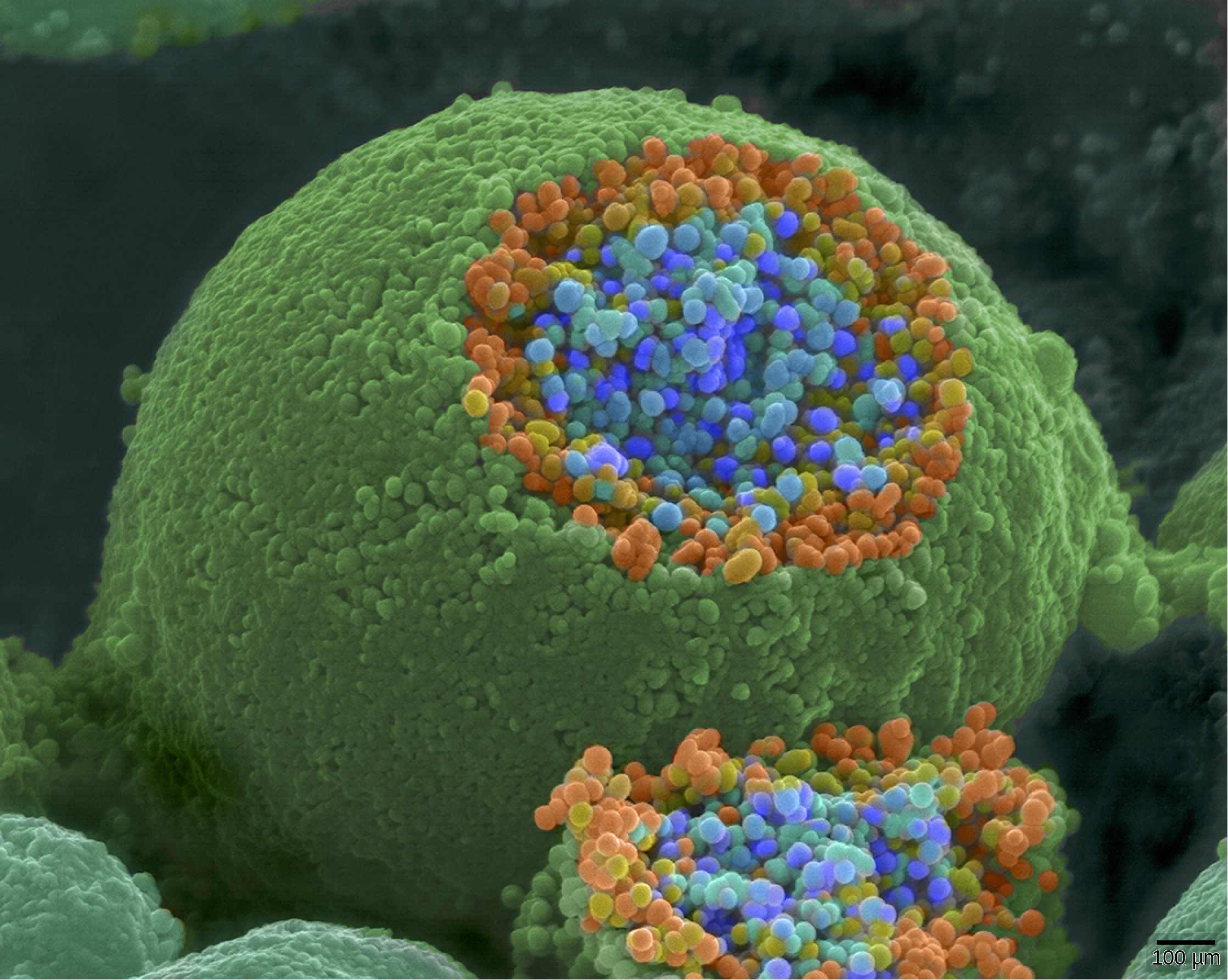 The axon terminal is spherical. A section is sliced off, revealing small blue and orange vesicles just inside.