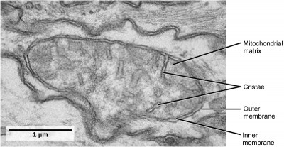This transmission electron micrograph of a mitochondrion shows an oval, outer membrane and an inner membrane with many folds called cristae. Inside of the inner membrane is a space called the mitochondrial matrix.