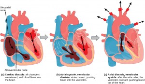 Illustration A shows cardiac diastole. The cardiac muscle is relaxed, and blood flows into the heart atria and into the ventricles. Illustration B shows atrial systole; the atria contract, pushing blood into the ventricles, which are relaxed. Illustration C shows atrial diastole; after the atria relax, the ventricles contract, pushing blood out of the heart. The sinoatrial node is located at the top of the right atrium, and the atrioventricular node is located between the right atrium and right ventricle. The heartbeat begins with an electrical impulse at the sinoatrial node, which spreads throughout the walls of the atria, resulting in a bump in the ECG reading. The signal then coalesces at the atrioventricular node, causing the ECG reading to flat-line briefly. Next, the signal passes from the atrioventricular node to the Purkinje fibers, which travel from the atriovenricular node and down the middle of the heart, between the two ventricles, then up the sides of the ventricles. As the signal passes down the Purkinje fibers the ECG reading falls. The signal then spreads throughout the ventricle walls, and the ventricles contract, resulting in a sharp spike in the ECG. The spike is followed by a flat-line, longer than the first, then a bump.