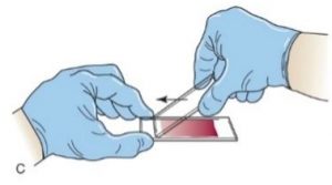 Making A Peripheral Blood Smear – Hematology Laboratory Manual