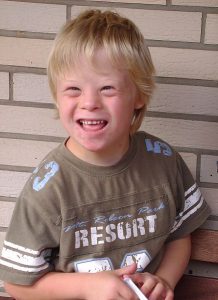 Down Syndrome is caused by the presence of all or part of an extra 21st chromosome.