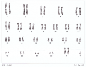 The 23 pairs of chromosomes.