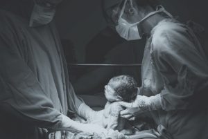 A baby being delivered by C-section.
