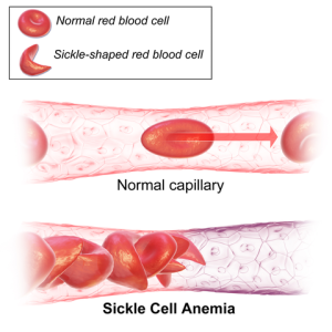 Healthy red blood cells are round/oval and sickle cells are sickle shaped (like a C)