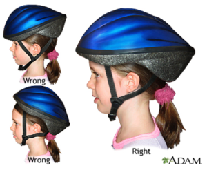 Helmet positioning is important.