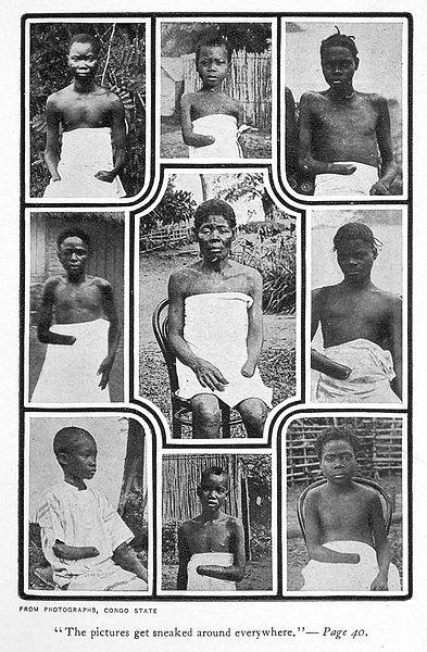 Photo collage of children in the Belgian Congo with severed hands and limbs.
