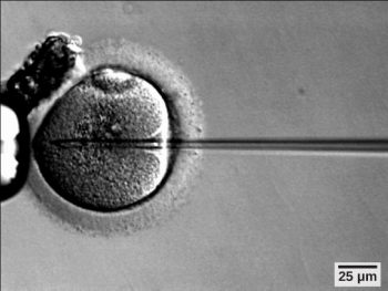 Chapter 9: Human Reproduction – NSCC Human Biology